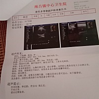 怎么算小孩多少斤