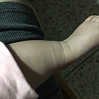 奇怪，为什么我今晚才看到宝宝脚上有一条这样的，又没穿袜子，不可能勒到啊，好担心啊，为什么会这样子呀？