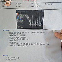 医生叫我少吃，主食， 明明都没有吃好的，你们有这样吗