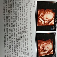 大家帮忙看一下男孩女孩，