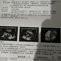 今天查的四维彩超，双绒双羊，在网上查了下有可能是异卵双胎，但翻了一下早期的B超单，是一个孕囊两个胚...