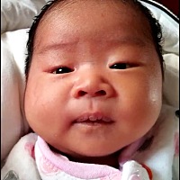 宝宝脸上痘痘怎么回事啊？