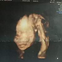 四维顺利通过，刚开始宝宝总是用手挡住脸蛋，医生说比较害羞😳，不知道像爸爸，还是妈妈呀