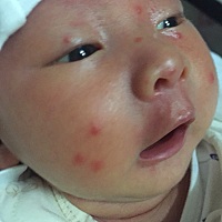 各位有经验的妈妈看看这是什么啊，从昨晚开始长的