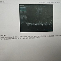 闺女你是真皮   动的超欢  就是不给脸看