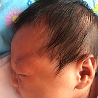 请问小宝宝左脸上起的痘痘是怎么回事？热的湿疹吗