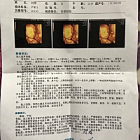 四维新鲜出炉，看看我们像谁