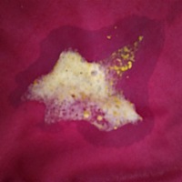 宝宝拉沫子有宝妈知道怎么回事的么？