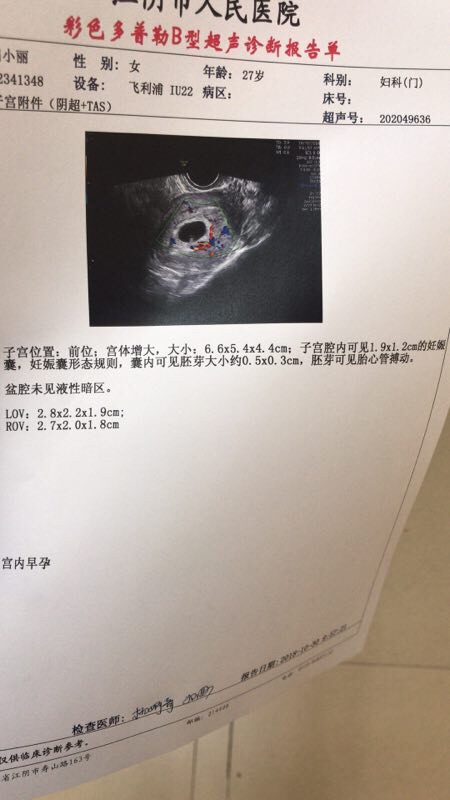 老婆怀孕六周，是第二胎了，感觉跟别人的相比有点小么……