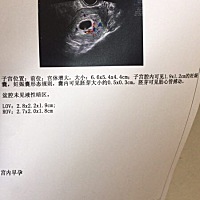 老婆怀孕六周，是第二胎了，感觉跟别人的相比有点小么……