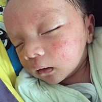 各位宝妈有经验的帮我看看宝宝脸上这个是怎么回事啊！谢谢！还在还没满月！心里着急！