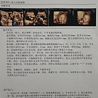 好好奇是男宝还是女宝，有会看的准的吗