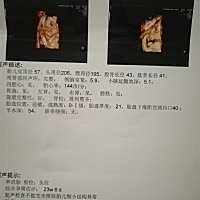 今天四维一次通过，孩子在吃手指，太可爱了