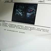 能帮我看看是男孩还是女孩 谁能看出是男孩还是女孩