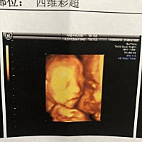 帮忙看看男女啦