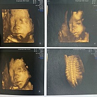 好别扭的感觉～你们第一次看到孩子的四维照片是什么感觉的^_^