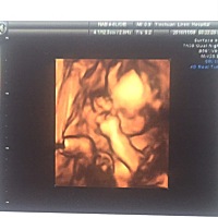 新鲜的四维通过，有会看的么？帮忙看看男孩女孩，纯属好奇