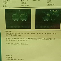 医生说：这样的情况下不能要孩子，我都不知道该怎么办😨    每月7号的大姨妈，今天9号了还没来，着急...