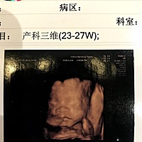 帮忙看看男宝女宝