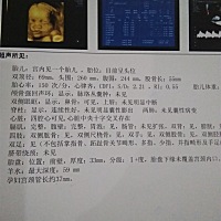 各位宝妈帮忙看看是男宝还是女宝