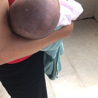 宝宝头长个包、不知道会不会有影响、求我宝宝健康快乐平安的成长