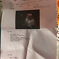 七个多月了，好像知道男女，有懂得吗？