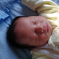 大家帮忙看看，小宝宝起了好多红疙瘩，怎么办啊！新手妈妈！急急急！