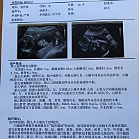 好想知道男孩还是女孩？纯属好奇，特地找了一家诊所做B超，但是还是没问出口！从十一月就休假在家了，孕...
