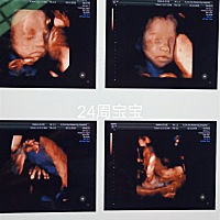 能看出是男宝女宝吗？