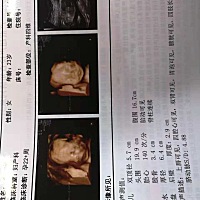 亲们谁会看 这是男孩女孩