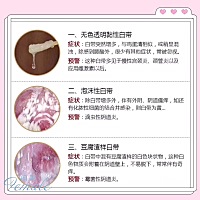 内裤一不小心就湿了，出门总有种不安的感觉...... 😳有时候白带，突然一下子增多，瘙痒、还伴随着一股...