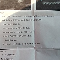 朋友们帮忙，看一下，我还有16天预产期，男宝女宝呀？绕颈两圈需要怎么做？