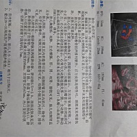 哪位大神帮我瞧瞧，能看得出是男宝还是女宝不？