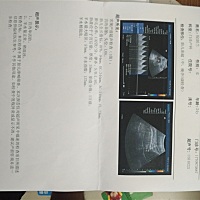 万能的怀孕圈，帮看下是男是女～～～