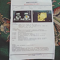 孕妈妈们猜猜对我来说都一样可是很想知道...............