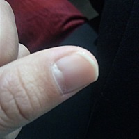 怀孕快六个月了，吃着钙片呢。指甲根部往下凹是怎么回事