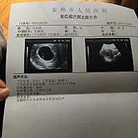 10周了，为什么看不到你，我盼了那么久，才盼到你的，为什么看不到你，你一定要坚强啊……快点长出来