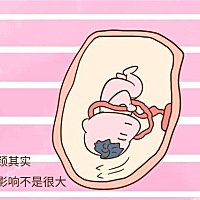 宝宝脐带绕颈怎么办？ 孩子脐带绕颈，严不严重，该怎么办？这是一个很多宝妈都有过的疑问，其实脐带...