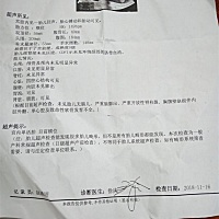 今天去做大排畸了，可是产科医生今天没上班，请问横位危险吗？