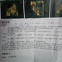 谁能帮忙看一下，谢谢了😃