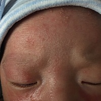 宝妈们……宝宝脸上湿疹有什么好办法么？看到心都碎了😭