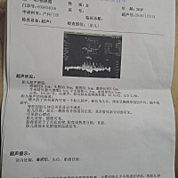 已经40周了，还是没有动静，求发动