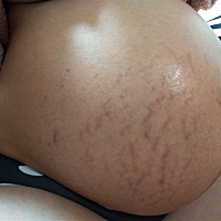 今天37周了，肚皮有点痒有点疼。这个肚子看着像男宝还是女宝啊？昨晚做了一个噩梦，梦见我怀的是女孩然...