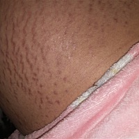 有没有同款肚子的？