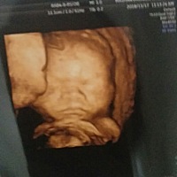 四维顺利通过，宝宝一直动，那个医生总是说动得超级快，还没来得及看清😘，嘴巴特别像爸爸，娱乐一下...