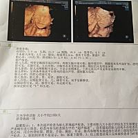 有谁会看男女，是男是女都好，主要想提前知道。