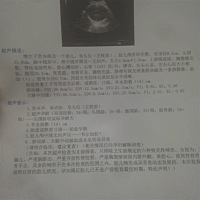 33周彩超检查，头围周36-，疑似韦尔加腔，问题大不大？有类似这种情况的孕妈咪吗