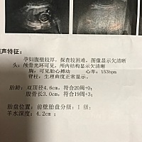 这个可能是男宝吗？
