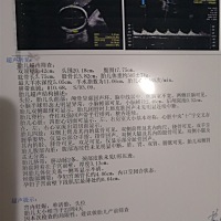 去检查四维一次顺利通过，有会看男女的宝妈吗？纯属好奇，谢谢