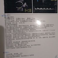 各位朋友帮忙看看男女，二胎，好奇，检查四维一次顺利通过，医生说宝宝笑了，还说鼻梁高😄